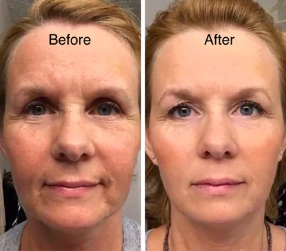 🔥Last Day Buy 2 Get 1 Free 🔥 Every day 5-minute daily ritual You can experience the effect of reducing swelling.