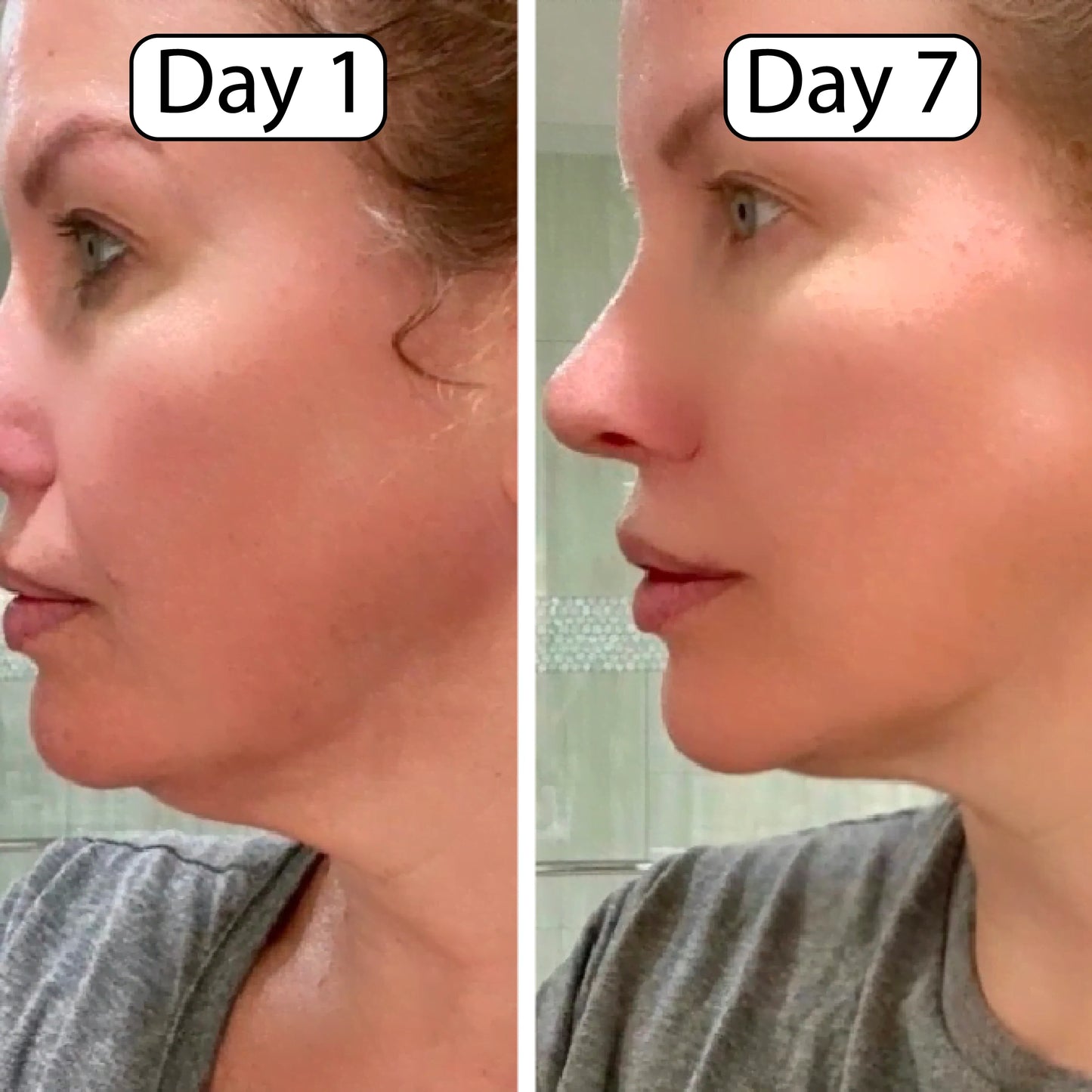 🔥Last Day Buy 2 Get 1 Free 🔥 Every day 5-minute daily ritual You can experience the effect of reducing swelling.